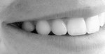 clR Photo